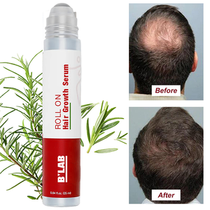 Roll on Hair Growth Serum Natural Rosemary Custom